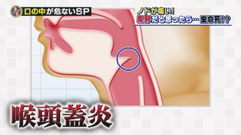喉頭浮腫とやらで緊急入院した(後日談)のメインビジュアル